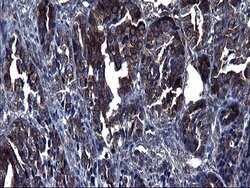 TUBA1A Monoclonal Antibody (OTI2C8), TrueMAB , OriGene 100 &mu;L; Unconjugated:Antibodies,