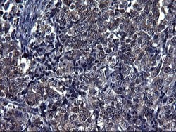 TUBA1A Monoclonal Antibody (OTI2C8), TrueMAB , OriGene:Antibodies:Primary