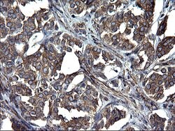 TUBA1A Monoclonal Antibody (OTI2C8), TrueMAB , OriGene 100 &mu;L; Unconjugated:Antibodies,