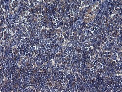 TUBA1A Monoclonal Antibody (OTI2C8), TrueMAB , OriGene 100 &mu;L; Unconjugated:Antibodies,