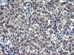 TUBA1A Monoclonal Antibody (OTI2C8), TrueMAB , OriGene 100 &mu;L; Unconjugated:Antibodies,
