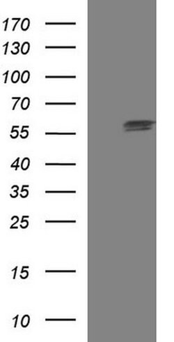 TUBA1A Monoclonal Antibody (OTI2C8), TrueMAB , OriGene 100 &mu;L; Unconjugated:Antibodies,