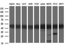 TUBA1A Monoclonal Antibody (OTI2C8), TrueMAB , OriGene 100 &mu;L; Unconjugated:Antibodies,