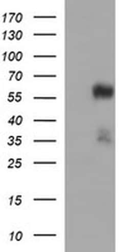 TUBA1B Monoclonal Antibody (OTI3H2), TrueMAB , OriGene 100 &mu;L; Unconjugated:Antibodies,