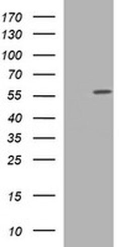 TUBA1C Monoclonal Antibody (OTI1D8), TrueMAB , OriGene:Antibodies:Primary