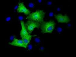 TUBA3E Mouse anti-Human, Clone: OTI2B4, lyophilized, TrueMAB 100 &mu;g;