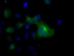 TUBA8 Mouse anti-Human, Clone: OTI2E9, lyophilized, TrueMAB 100 &mu;g;