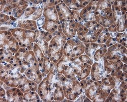 TUBA8 Mouse anti-Human, Clone: OTI3E10, lyophilized, TrueMAB 100 &mu;g;