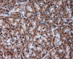 TUBA8 Monoclonal Antibody (OTI3E10), TrueMAB , OriGene:Antibodies:Primary