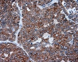 TUBA8 Mouse anti-Human, Clone: OTI3E10, lyophilized, TrueMAB 100 &mu;g;
