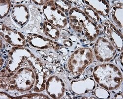 TUBA8 Mouse anti-Human, Clone: OTI3E10, lyophilized, TrueMAB 100 &mu;g;