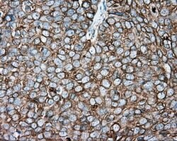 TUBA8 Monoclonal Antibody (OTI2G6), TrueMAB , OriGene 100 &mu;L; Unconjugated:Antibodies,