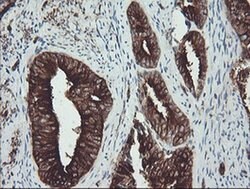 TUBA8 Monoclonal Antibody (OTI2G6), TrueMAB , OriGene 100 &mu;L; Unconjugated:Antibodies,