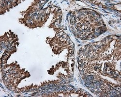TUBA8 Monoclonal Antibody (OTI2G6), TrueMAB , OriGene 100 &mu;L; Unconjugated:Antibodies,