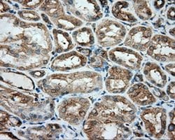 TUBA8 Monoclonal Antibody (OTI2G6), TrueMAB , OriGene:Antibodies:Primary