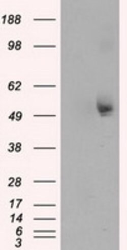 TUBA8 Mouse anti-Human, Clone: OTI3E10, lyophilized, TrueMAB 100 &mu;g;