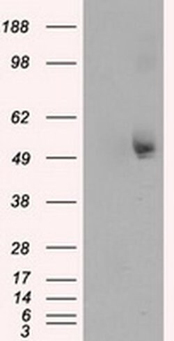 TUBA8 Monoclonal Antibody (OTI3E10), TrueMAB , OriGene:Antibodies:Primary
