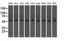 TUBA8 Mouse anti-Human, Clone: OTI3E10, lyophilized, TrueMAB 100 &mu;g;