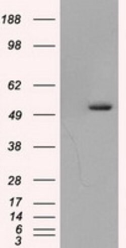 TUBA8 Mouse anti-Human, Clone: OTI2E9, lyophilized, TrueMAB 100 &mu;g;