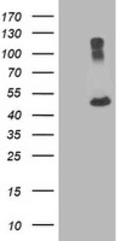 TUBA8 Mouse anti-Human, Clone: OTI3G2, lyophilized, TrueMAB 100 &mu;g;