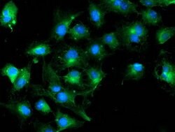 TUBAL3 Mouse anti-Human, Clone: OTI4D8, lyophilized, TrueMAB 100 &mu;g;