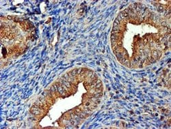 TUBAL3 Monoclonal Antibody (OTI5E4), TrueMAB , OriGene:Antibodies:Primary