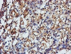 TUBAL3 Monoclonal Antibody (OTI5E4), TrueMAB , OriGene:Antibodies:Primary