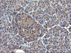 TUBAL3 Mouse anti-Human, Clone: OTI4D8, lyophilized, TrueMAB 100 &mu;g;