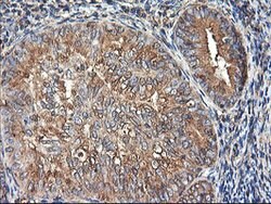 TUBAL3 Mouse anti-Human, Clone: OTI4D8, lyophilized, TrueMAB 100 &mu;g;