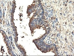 TUBAL3 Mouse anti-Human, Clone: OTI4D8, lyophilized, TrueMAB 100 &mu;g;