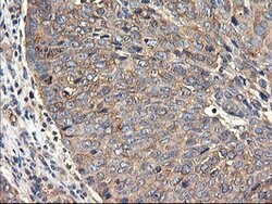 TUBAL3 Mouse anti-Human, Clone: OTI4D8, lyophilized, TrueMAB 100 &mu;g;