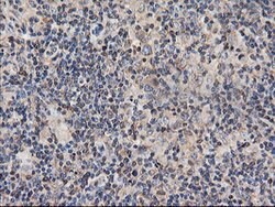TUBAL3 Mouse anti-Human, Clone: OTI4D8, lyophilized, TrueMAB 100 &mu;g;