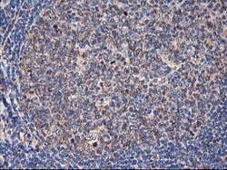 TUBAL3 Mouse anti-Human, Clone: OTI4D8, lyophilized, TrueMAB 100 &mu;g;