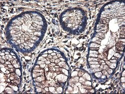TUBAL3 Mouse anti-Human, Clone: OTI4D8, lyophilized, TrueMAB 100 &mu;g;