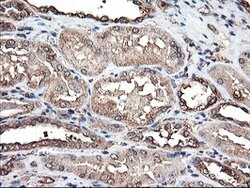 TUBAL3 Mouse anti-Human, Clone: OTI4D8, lyophilized, TrueMAB 100 &mu;g;