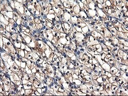 TUBAL3 Mouse anti-Human, Clone: OTI4D8, lyophilized, TrueMAB 100 &mu;g;