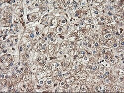 TUBAL3 Mouse anti-Human, Clone: OTI4D8, lyophilized, TrueMAB 100 &mu;g;
