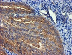 TUBAL3 Monoclonal Antibody (OTI4D9), TrueMAB , OriGene 100 &mu;L; Unconjugated:Antibodies,