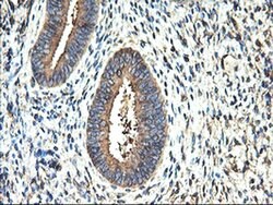 TUBAL3 Monoclonal Antibody (OTI1G6), TrueMAB , OriGene 100 &mu;L; Unconjugated:Antibodies,