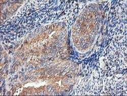 TUBAL3 Monoclonal Antibody (OTI1G6), TrueMAB , OriGene 100 &mu;L; Unconjugated:Antibodies,