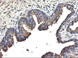 TUBAL3 Monoclonal Antibody (OTI1G6), TrueMAB , OriGene 100 &mu;L; Unconjugated:Antibodies,