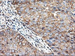 TUBAL3 Monoclonal Antibody (OTI1G6), TrueMAB , OriGene 100 &mu;L; Unconjugated:Antibodies,