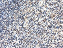TUBAL3 Monoclonal Antibody (OTI1G6), TrueMAB , OriGene 100 &mu;L; Unconjugated:Antibodies,