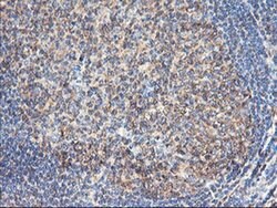 TUBAL3 Monoclonal Antibody (OTI1G6), TrueMAB , OriGene 100 &mu;L; Unconjugated:Antibodies,