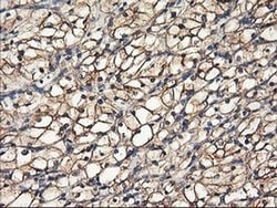 TUBAL3 Monoclonal Antibody (OTI1G6), TrueMAB , OriGene 100 &mu;L; Unconjugated:Antibodies,