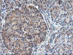 TUBAL3 Monoclonal Antibody (OTI2F6), TrueMAB , OriGene 30 &mu;L; Unconjugated:Antibodies,