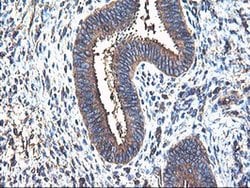 TUBAL3 Monoclonal Antibody (OTI2F6), TrueMAB , OriGene 30 &mu;L; Unconjugated:Antibodies,