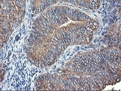 TUBAL3 Monoclonal Antibody (OTI2F6), TrueMAB , OriGene 30 &mu;L; Unconjugated:Antibodies,