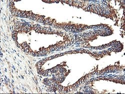 TUBAL3 Monoclonal Antibody (OTI2F6), TrueMAB , OriGene 30 &mu;L; Unconjugated:Antibodies,