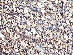 TUBAL3 Monoclonal Antibody (OTI2F6), TrueMAB , OriGene 30 &mu;L; Unconjugated:Antibodies,